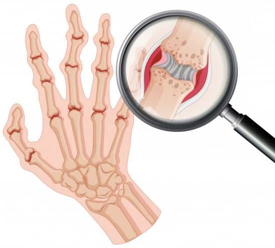 Poland - metonil apteka gemini Poland - metonil apteka gemini